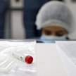 Epidemia w Polsce: Ponad 500 kolejnych zakażonych koronawirusem
