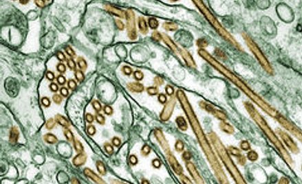Wirus H5N1 to najgroźniejszy wirus ptasiej grypy