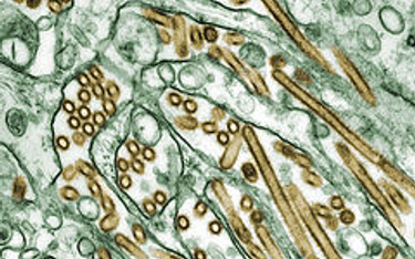 Wirus H5N1 to najgroźniejszy wirus ptasiej grypy