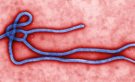 Ebola pod mikroskopem.