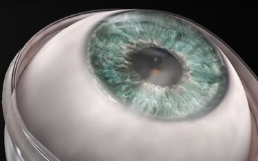 Niewidomy mężczyzna odzyskał wzrok. Rewolucyjny implant