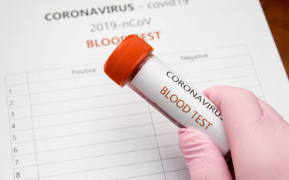 Koronawirus a świadczenia z ZUS: za okres kwarantanny przysługują świadczenia z tytułu choroby