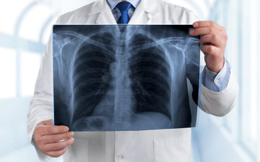 Włochy: Epidemia zachorowań na zapalenie płuc