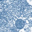 Wirus Nipah jest blisko spokrewniony z wirusem Hendra