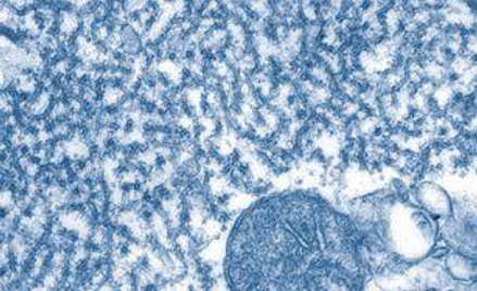 Wirus Nipah jest blisko spokrewniony z wirusem Hendra