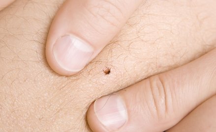 Lekarze POZ nie skierują na testy na boreliozę. MZ: to byłoby zbyt ryzykowne