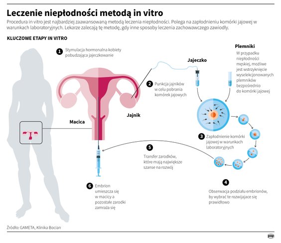 Leczenie niepłodności metodą in vitro