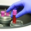 Światowe koncerny pracują nad nowymi lekami na otyłość. Skutki problemów z nadwagą są większe niż do