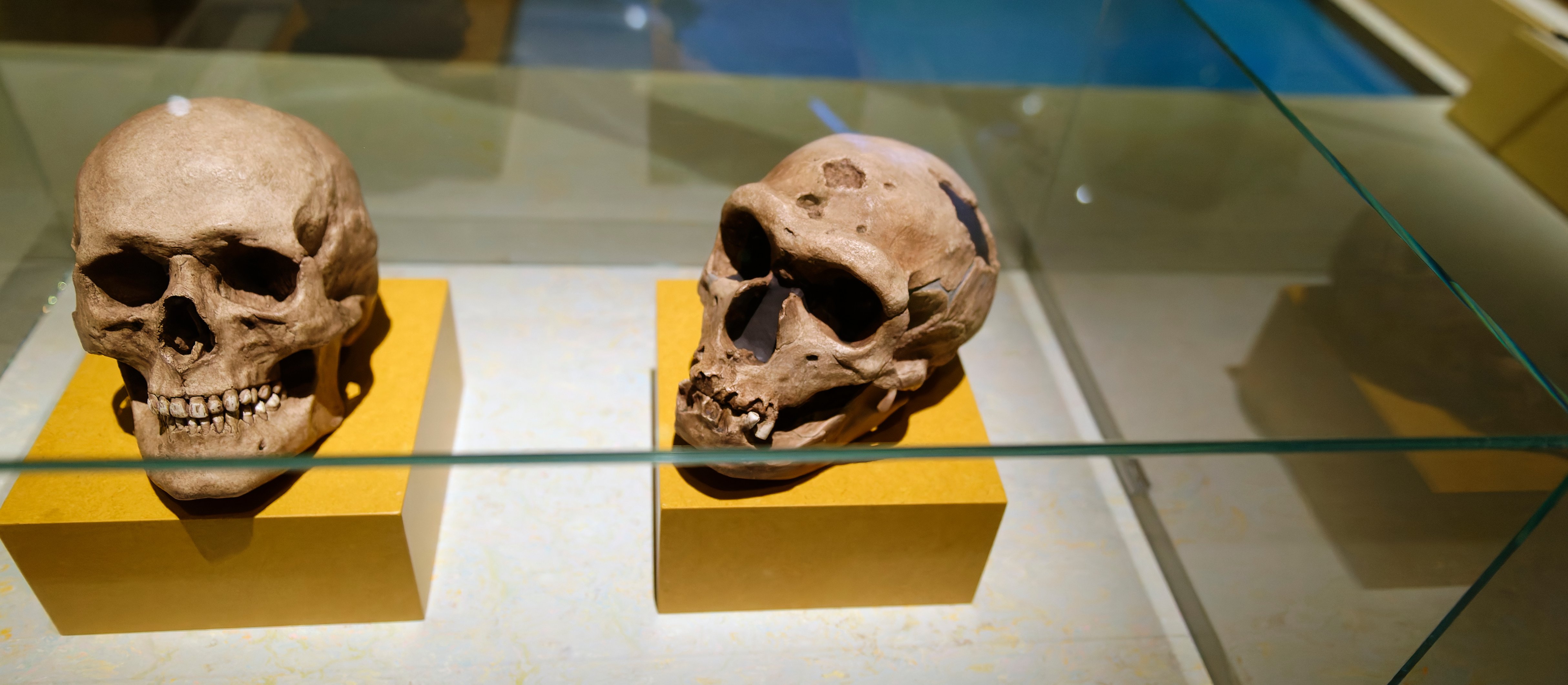 Neandertalczycy ulieli leczyć zęby. Naukowcy dowód znaleźli w Rosji
