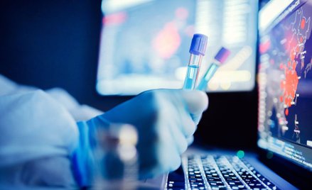 Ulga B+R i IP Box: sposób na poprawę płynności firm w czasie epidemii