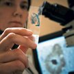 Złogi beta-amyloidu są charakterystyczne dla choroby Alzheimera