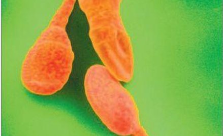 Zdrowy mężczyzna produkuje ok. 150 mln plemników dziennie