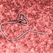 Niepozorna laseczka – tak wygląda śmiercionośny wirus Ebola pod mikroskopem