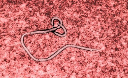 Niepozorna laseczka – tak wygląda śmiercionośny wirus Ebola pod mikroskopem