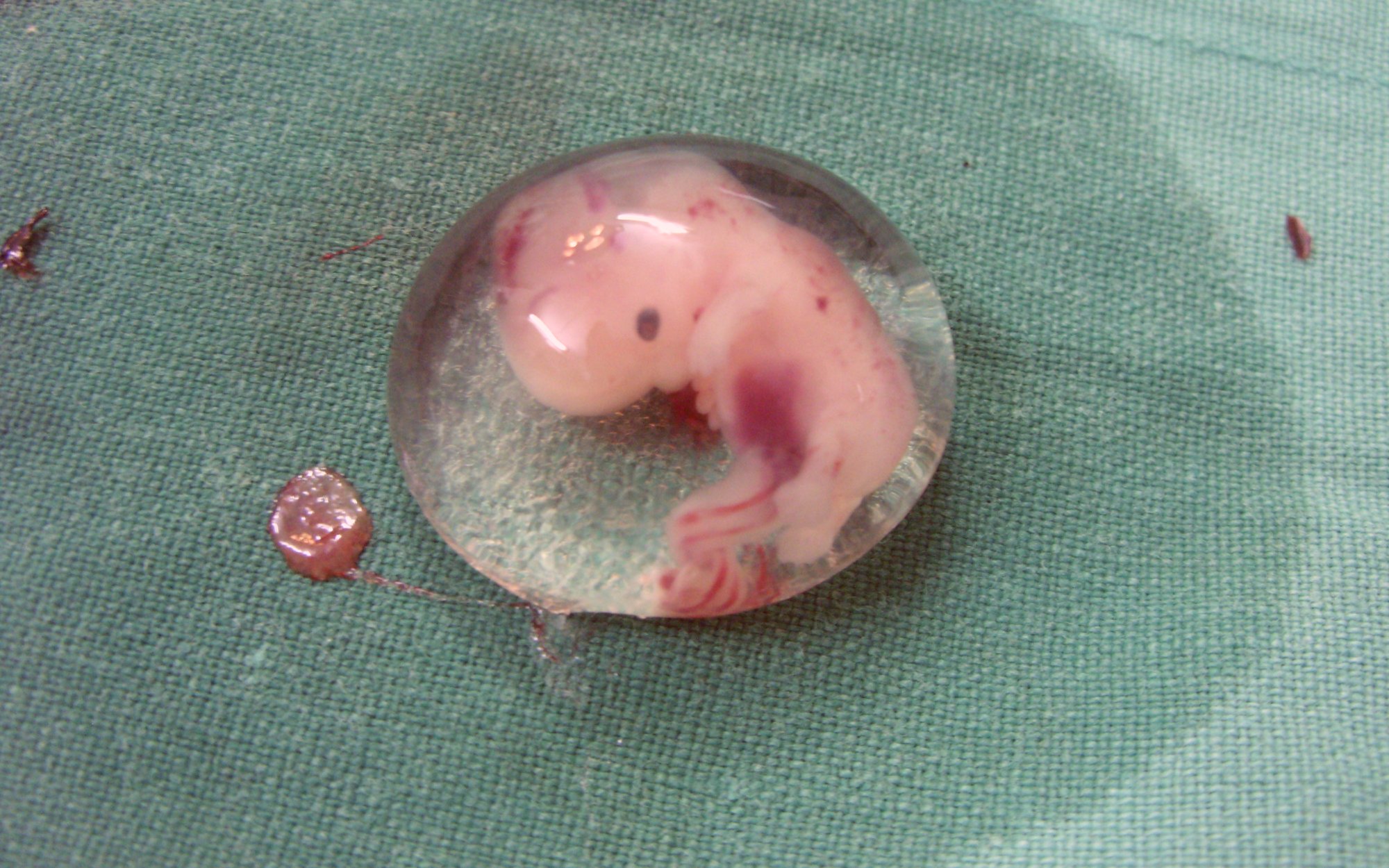 Hodowla ludzi bez mózgów na organy? Kontrowersyjny projekt z Doliny Krzemowej