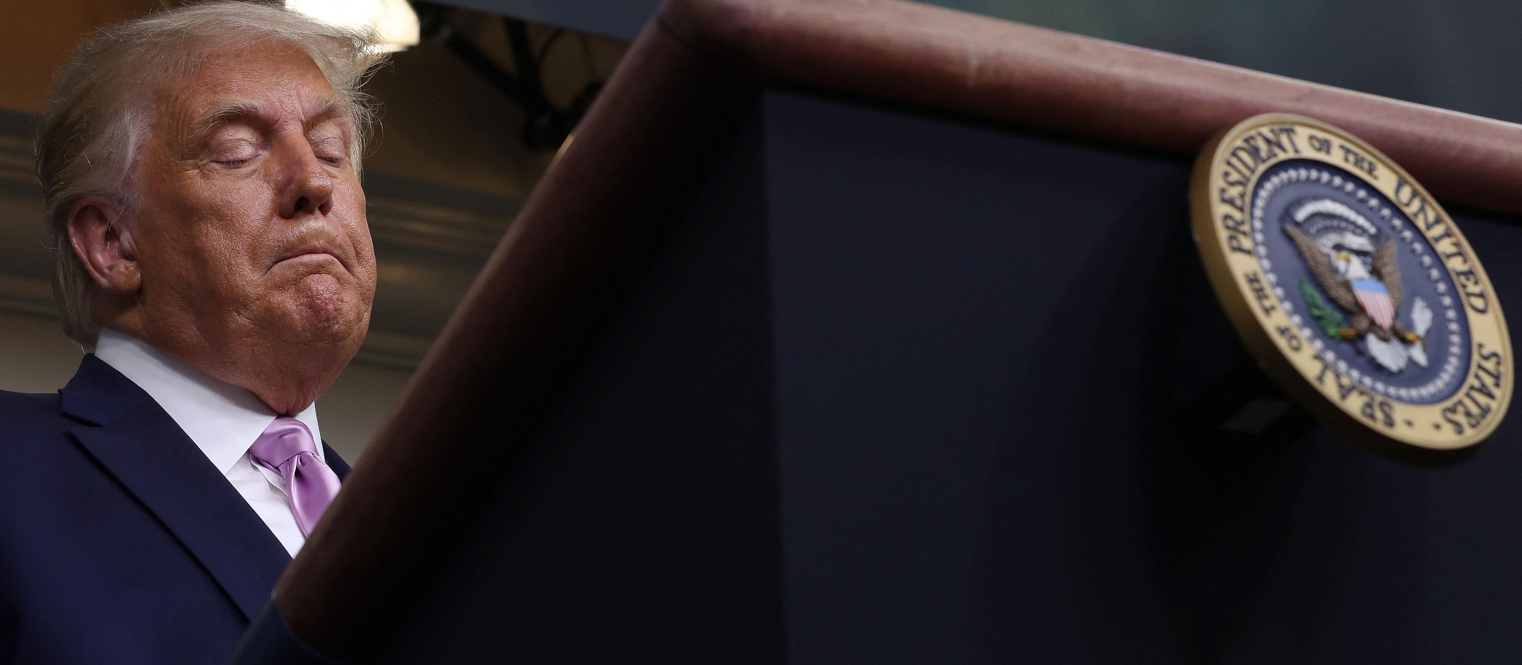 Wiek dopada Donalda Trumpa, czyli skąd ten siniak?