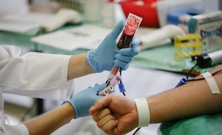 Nie ma krwi, nie będzie zabiegu