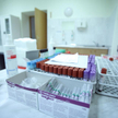 Nowe otwarcie w walce z HIV/AIDS