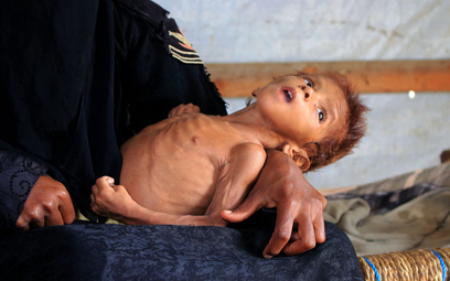 ONZ: Jemen coraz bliżej klęski głodu
