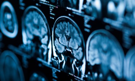 Naukowcy odkryli, który neuroprzekaźnik w mózgu pomaga nam zmieniać stare nawyki