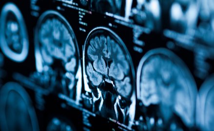 Naukowcy odkryli, który neuroprzekaźnik w mózgu pomaga nam zmieniać stare nawyki