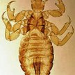 Wszy głowowe to małe owady (2 – 3 mm długości). Żywią się krwią. Mogą podrażniać skórę i powodować a
