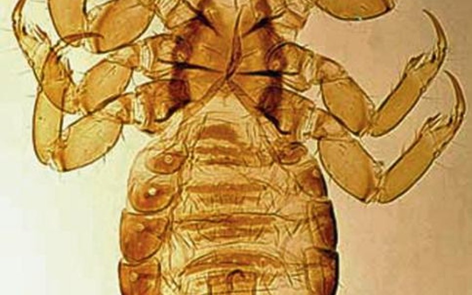 Wszy głowowe to małe owady (2 – 3 mm długości). Żywią się krwią. Mogą podrażniać skórę i powodować a