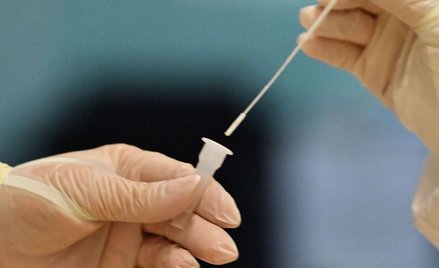 Koronawirus w Polsce. Liczba nowych przypadków SARS-CoV-2 systematycznie maleje