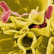 Zmodyfikowana salmonella sposobem na guzy mózgu