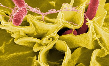 Zmodyfikowana salmonella sposobem na guzy mózgu
