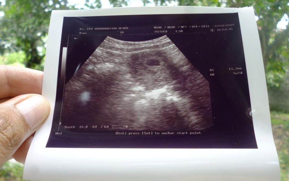 Zamiast in vitro zrefundują diagnostykę przyczyn niepłodności