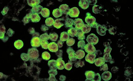 Teksas: Ameba żywiąca się mózgiem w źródle wody dla miast