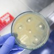 Naukowcy odkryli nowy antybiotyk, który działa na bakterie w zupełnie inny sposób