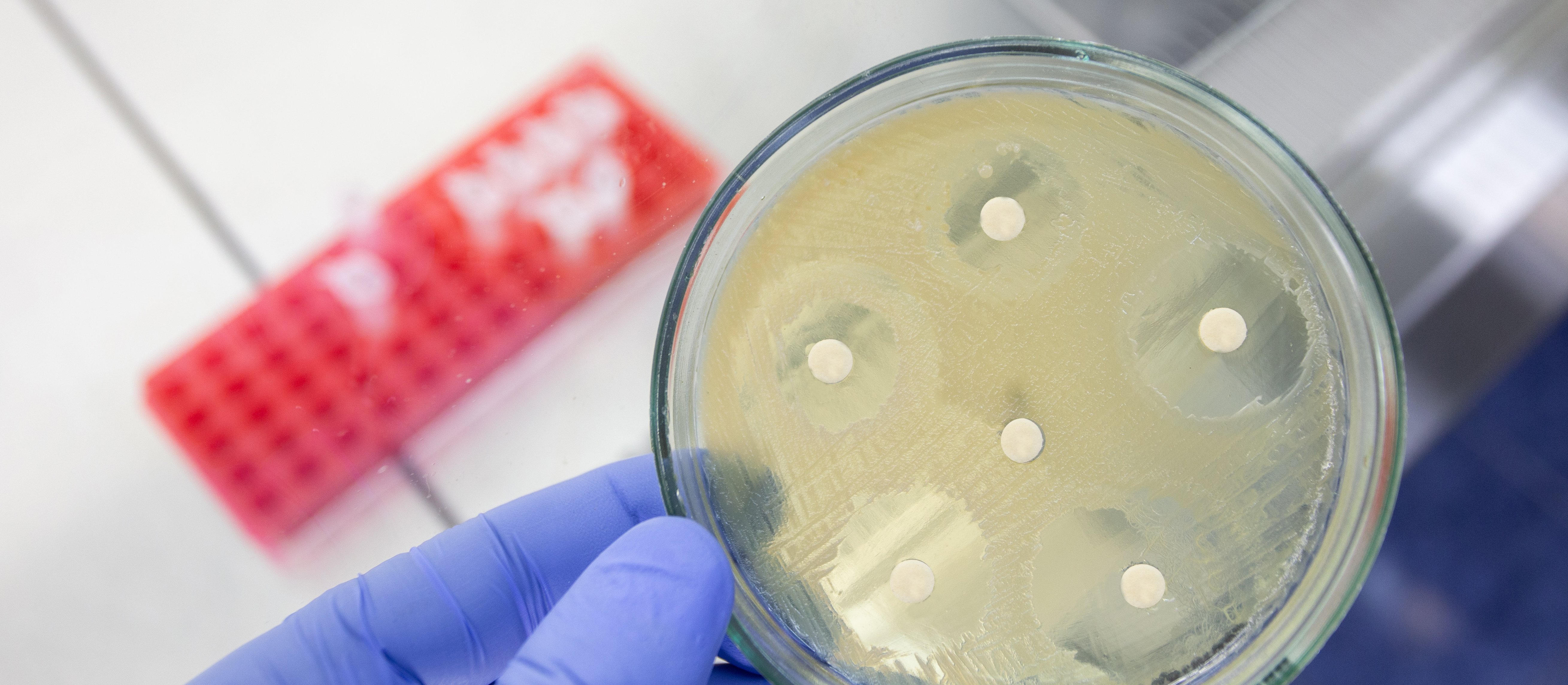 Antybiotyk wymierzony w superbakterie. Naukowcy właśnie dokonali „niemożliwego”