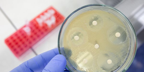 Kanadyjscy naukowcy odkryli antybiotyk manikomycynę skuteczną wobec superbakterii