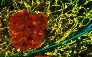 Sieć mitochondrialna w komórce (żółte smugi).