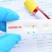 BioMaxima dostarczy testy na Covid-19 za 94,8 mln zł