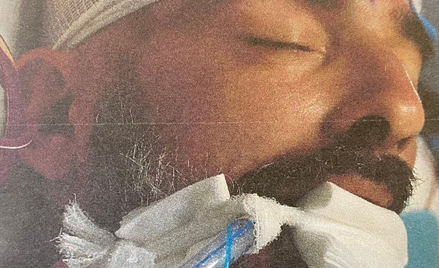 Policja poszukuje bliskich potrąconego mężczyzny. Nie wiadomo, kim jest