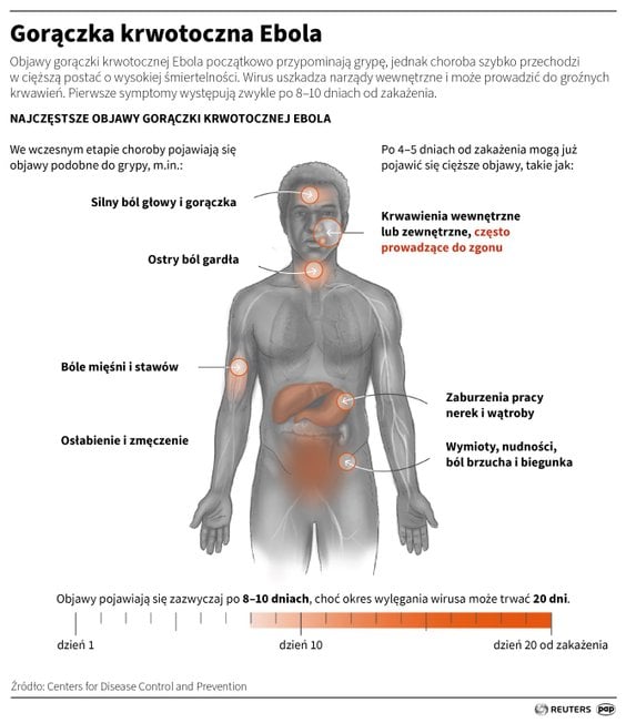 Gorączka krwotoczna Ebola