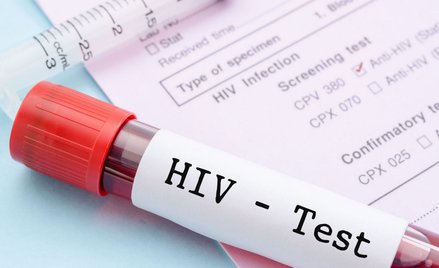 USA: Nowa terapia chorych na HIV z akceptacją FDA