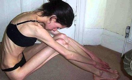 Francja żegna chude modelki