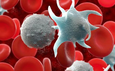 W przebiegu białaczki dochodzi do powstawania nadmiernej liczby nieprawidłowych limfocytów.