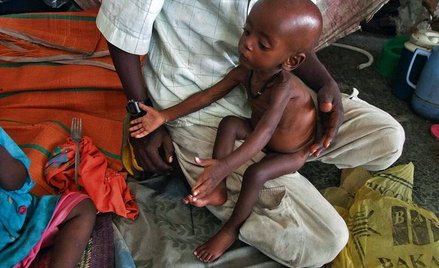 Ofiara głodu w Somalii, sierpień 2011 r. (fot. Farah Abdi Warsameh)