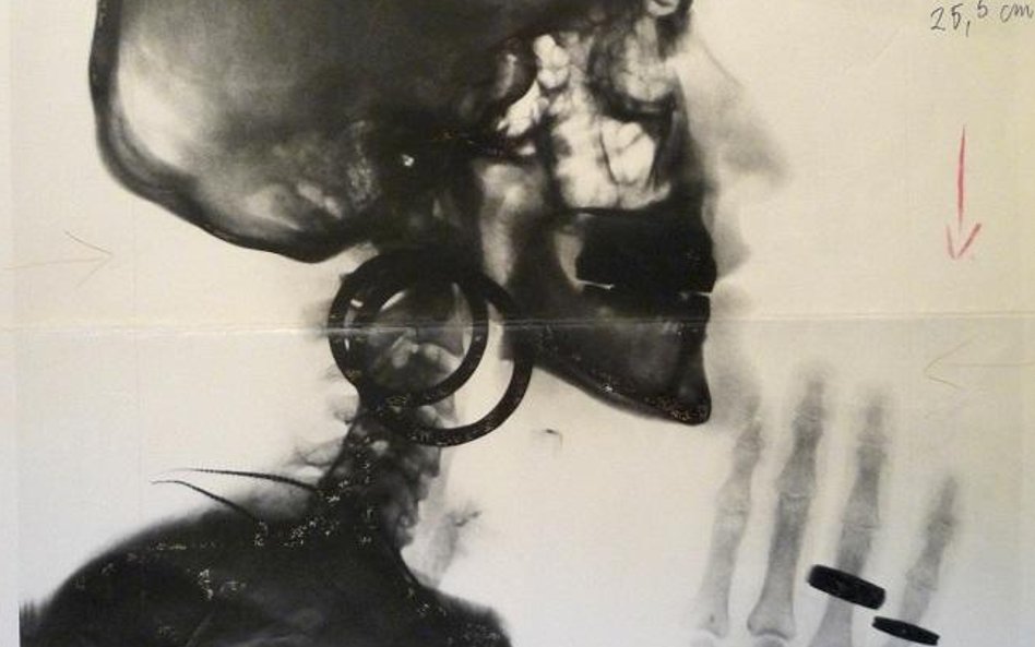 Meret Oppenheim, Szkic do zdjęcia rentgenowskiego czaszki M.O. (Entwurf für X-Ray – Röntgenaufnahme 