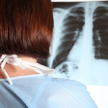 Potrzebne są skuteczne terapie we wszystkich liniach leczenia nowotworów