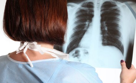 Potrzebne są skuteczne terapie we wszystkich liniach leczenia nowotworów