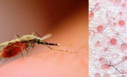 Komar przenoszący pasożyty powodujące malarię