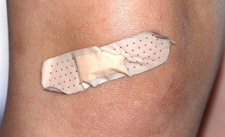 Elastyczny klej chirurgiczny zamyka rany w ciągu 60 sekund