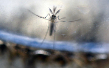Zakażenie wirusem Zika kobiety w ciąży może wywoływać małogłowie u jej dziecka