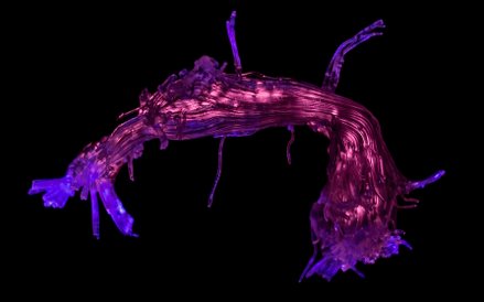 Fot: Stephanie J Forkel, Ahmad Beyh, Natbrainlab, Alfonso de Lara Rubio. Zdjęcie pokazuje rekonstruk